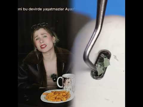 #shorts #youtubeshorts #shortsforyou #viralshorts#fyp