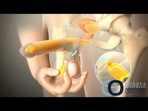 Malattie e sintomi del pene