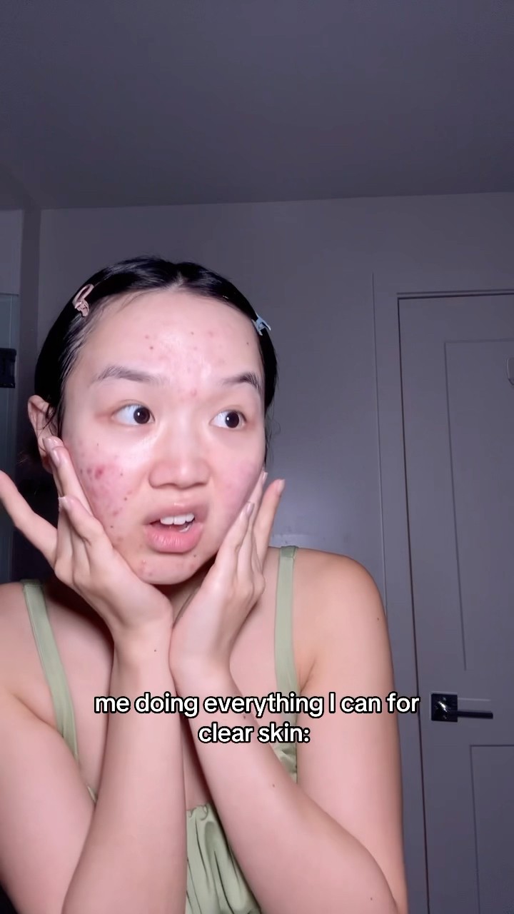 Kulit mereka memang punya keunikan tersendiri! 🫡✨ Siapa yang mau coba tips skincare-nya?