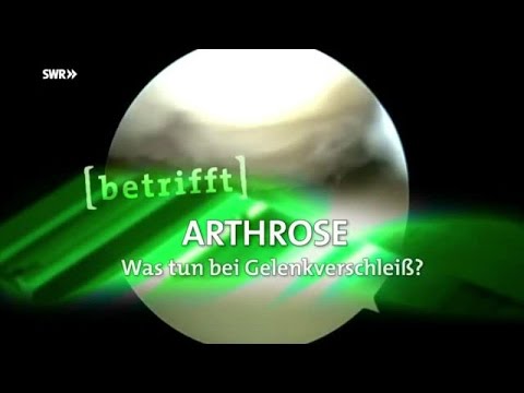 Wie viel des Halswirbels in der Wirbelsäule Giraffe Ist Nurofen Osteochondrose