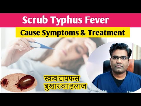 Scrub Typhus Cause Symptoms and Treatment Explained | What is Scrub Typhus Fever?