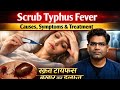 Scrub Typhus Cause Symptoms And Treatment Explained What Is Scrub Typhus Fever