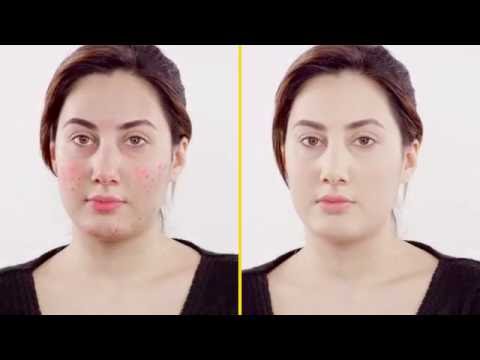 Come coprire l’acne - RiparCover Camouflage