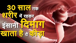 Brain Tapeworm | Body को अंदर से खाने वाला कीड़ा जो कई खाने की चीजों में होता है | Cabbage | News video