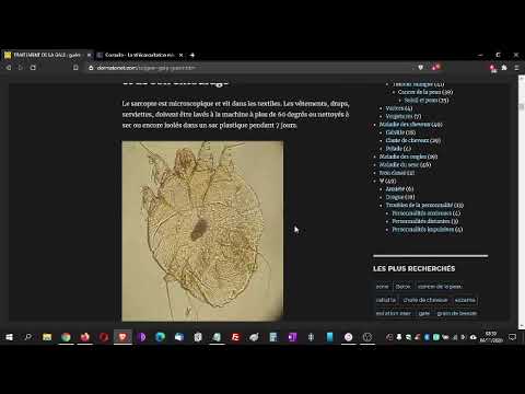 Vidéo protocole complet traitement gale