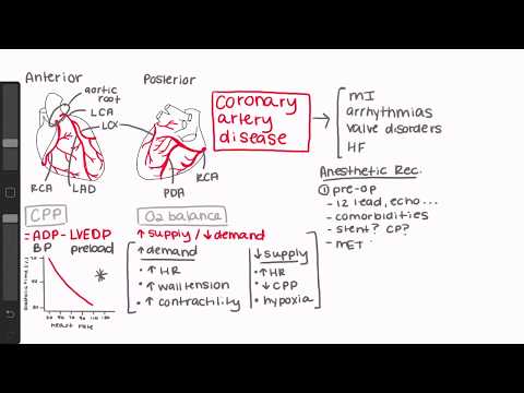 Anesthesia Implications for Coronary Artery Disease