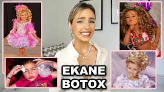 ΕΚΑΝΕ BOTOX ΓΙΑ ΤΑ ΠΑΙΔΙΚΑ ΚΑΛΛΙΣΤΕΙΑ | Manuella