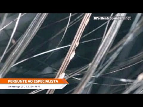 The solution for white balls in hair