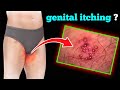 Genital Itching पुरूषों के प्राइवेट पार्ट में ख�