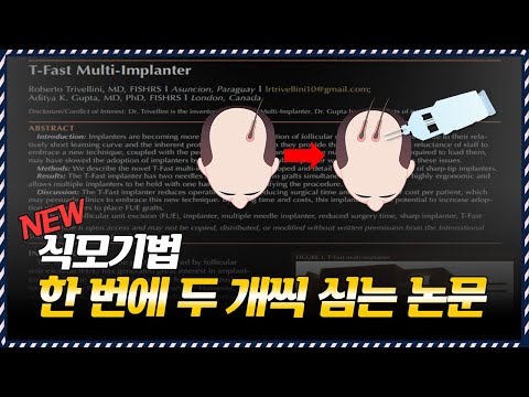 의느님답변????한방에????두 개씩 심는????T-Fast Multi-implanter ????논문리뷰 part.1 ㅣ다나성형외과(DANA)ㅣ모발이식ㅣ헤어라인교정ㅣ두피문신ㅣ탈모치료