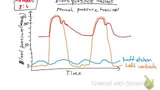 Blood pressure tracings
