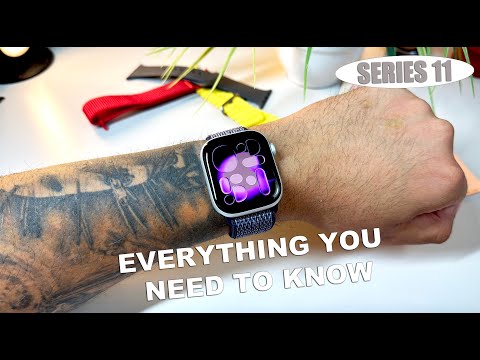 Apple Watch Series 11 Unboxing & Review (2025) | WATCH THIS BEFORE BUYING!