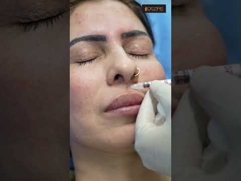 Botox Treatment Procedures #shortsvideo