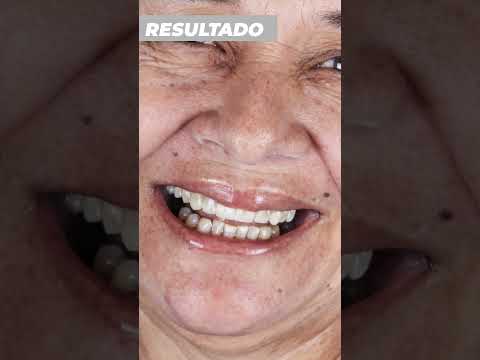 Werlin Torres Odontología Integral y Estética  image-gallery-testimonios