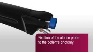 Manipulator maciczny SecuFix