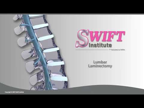 Lumbar Laminectomy for spinal stenosis treatment - Reno Spine Neurosurgeons | Swift Institute