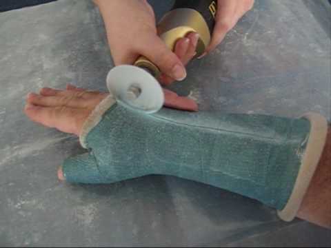 Schmerzen in der rechten Seite, wenn auf dem Rücken liegend Arthritischen Gelenke der Hände ICD-Code