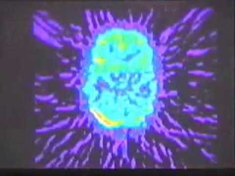 [Doku] Magic Mushrooms - Narrenschwämme