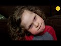The Story Of Piper The Only Known Case With Her Rare Genetics