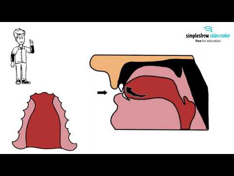 Aussprache: Was ist Lispeln? Und weshalb klingt bei manchen das "s" anders?