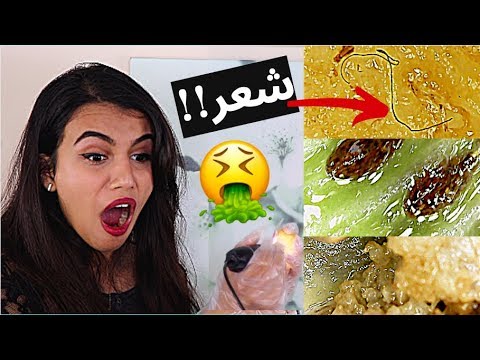 شوفوا كيف شكل الأكل تحت الميكروسكوب | ما رح تصدقوا ايش لقيت 😱🔬!!!