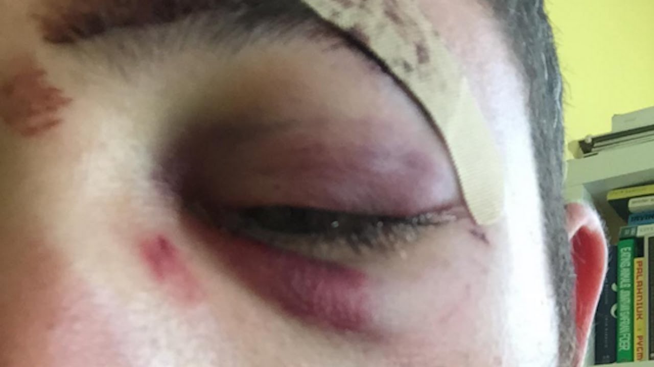 Shia LaBeouf Lookalike Gets PUNCHED By Stranger | What's Trending Now