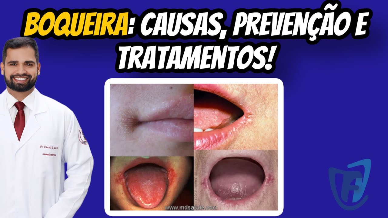 Francisco De Assis Almeida Lima Júnior-53