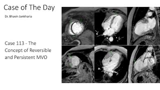 Case of the Day - 113 - 2025 10 06 - The Concept of Reversible and Persistent MVO