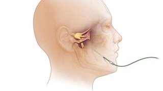 Fighting Face Pain - Mayo Clinic