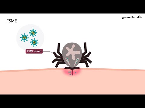 TBE: Which diseases do ticks transmit?