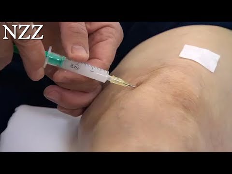 Volkskrankheit Rheuma - Dokumentation von NZZ Format (2008)