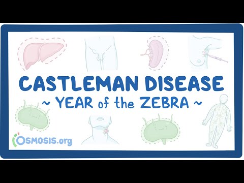 Achalasia Year of the Zebra