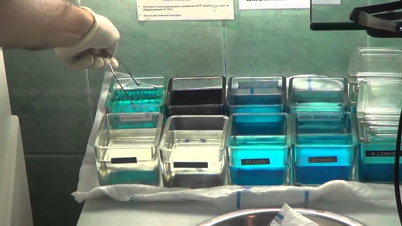 Pablo Umbert Millet-10