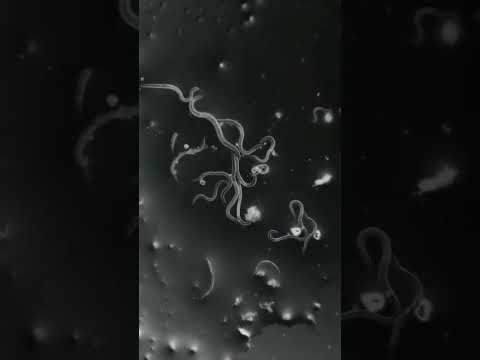 dust in our nails in microscope view #shorts #microscope #nails #germs