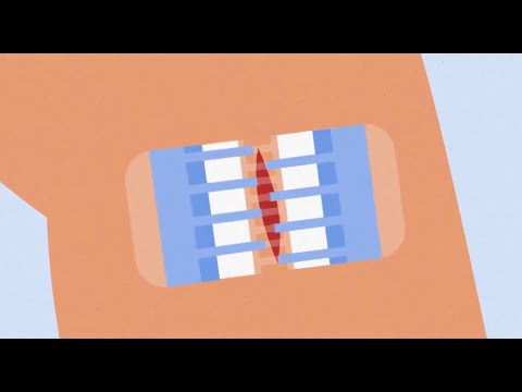 Clozex Animation Video