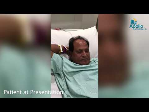 Reverse Stroke – Successful management of stroke at Apollo Hospitals