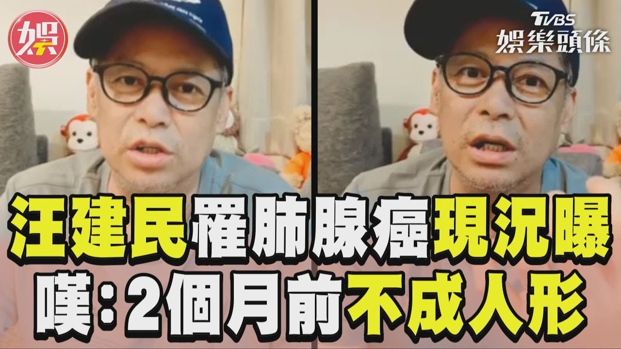影音/汪建民「肺腺癌4期」直播露臉 嘆化療如打仗:瘦到不成人形