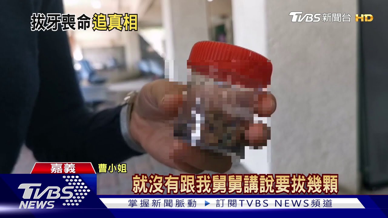 全口蛀牙一次拔20顆 女子翌日昏迷9天後亡