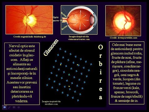 Raport privind îngrijirea oftalmică pentru copii