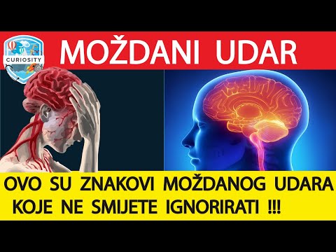 Moždani udar, vrste, uzroci, simptomi, liječenje Dr#120