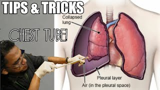 Tips and Tricks on HOW TO INSERT CHEST TUBE!