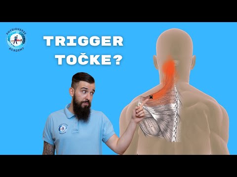 Što su Trigger točke i zašto stvaraju bolove?