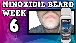Minoxidil Beard | Week 6 | The Experiment |  #FacialFuzzFridays