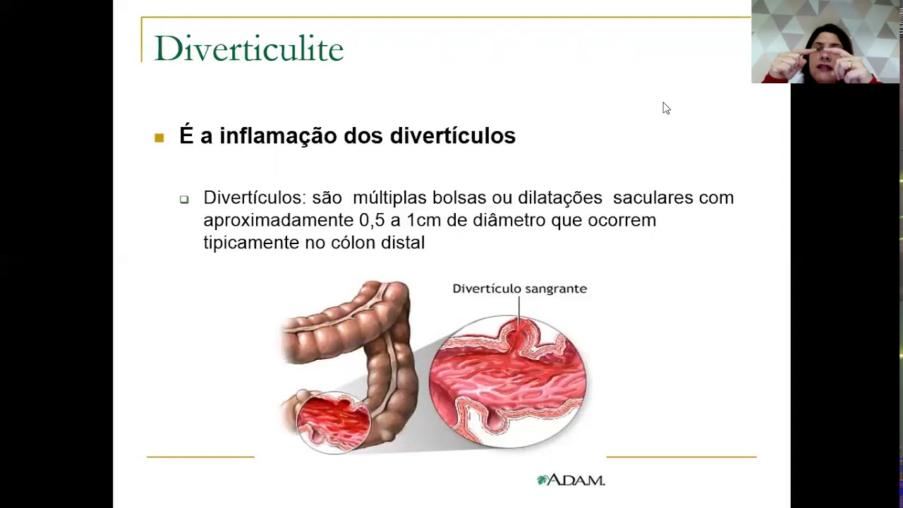 Principais distúrbios gastrointestinais
