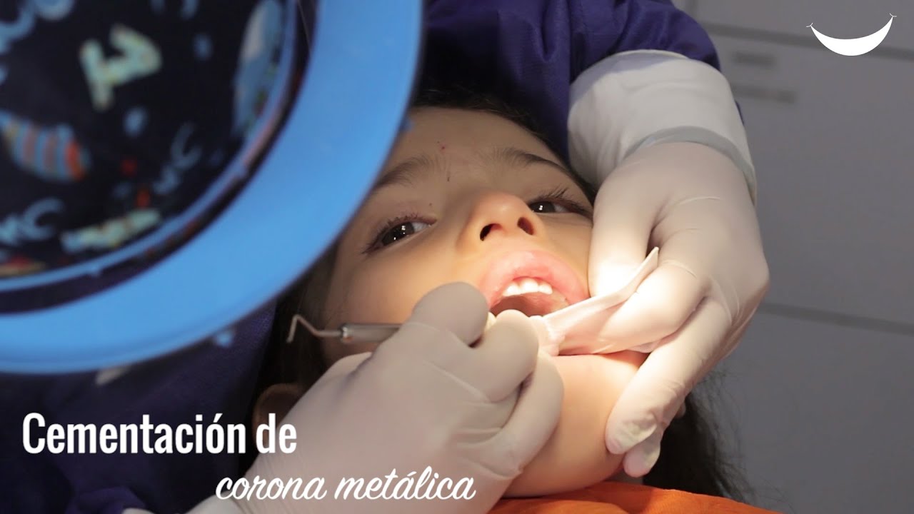 Watch Corona dental en odontopediatría: Now Corona dental en odontopediatría: