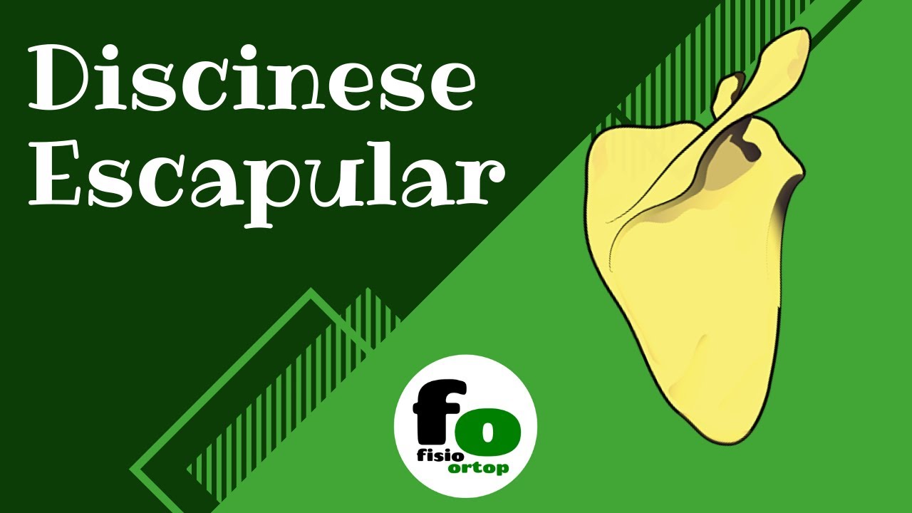 DISCINESE ESCAPULAR | O que é? #01