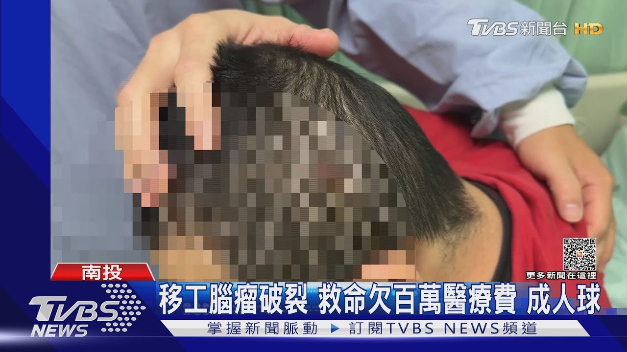逃逸移工腦瘤破裂 救回一命欠百萬醫療費成人球