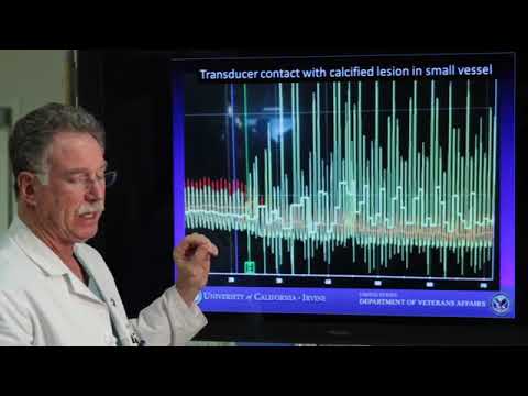 FFR Basics Practice Pitfalls