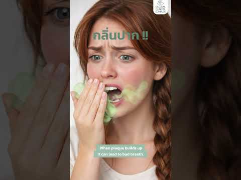 Do dental veneers cause bad breath?