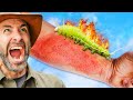 Stung By The Dragon Flame Caterpillar